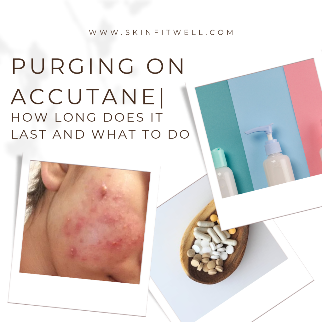 how-long-does-purging-last-on-accutane-skin-fit-well-skin-fit-well