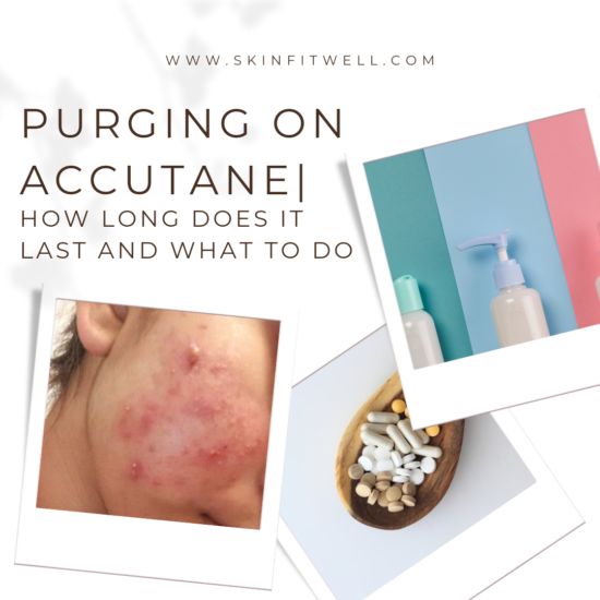 how-long-does-purging-last-on-accutane-skin-fit-well-skin-fit-well