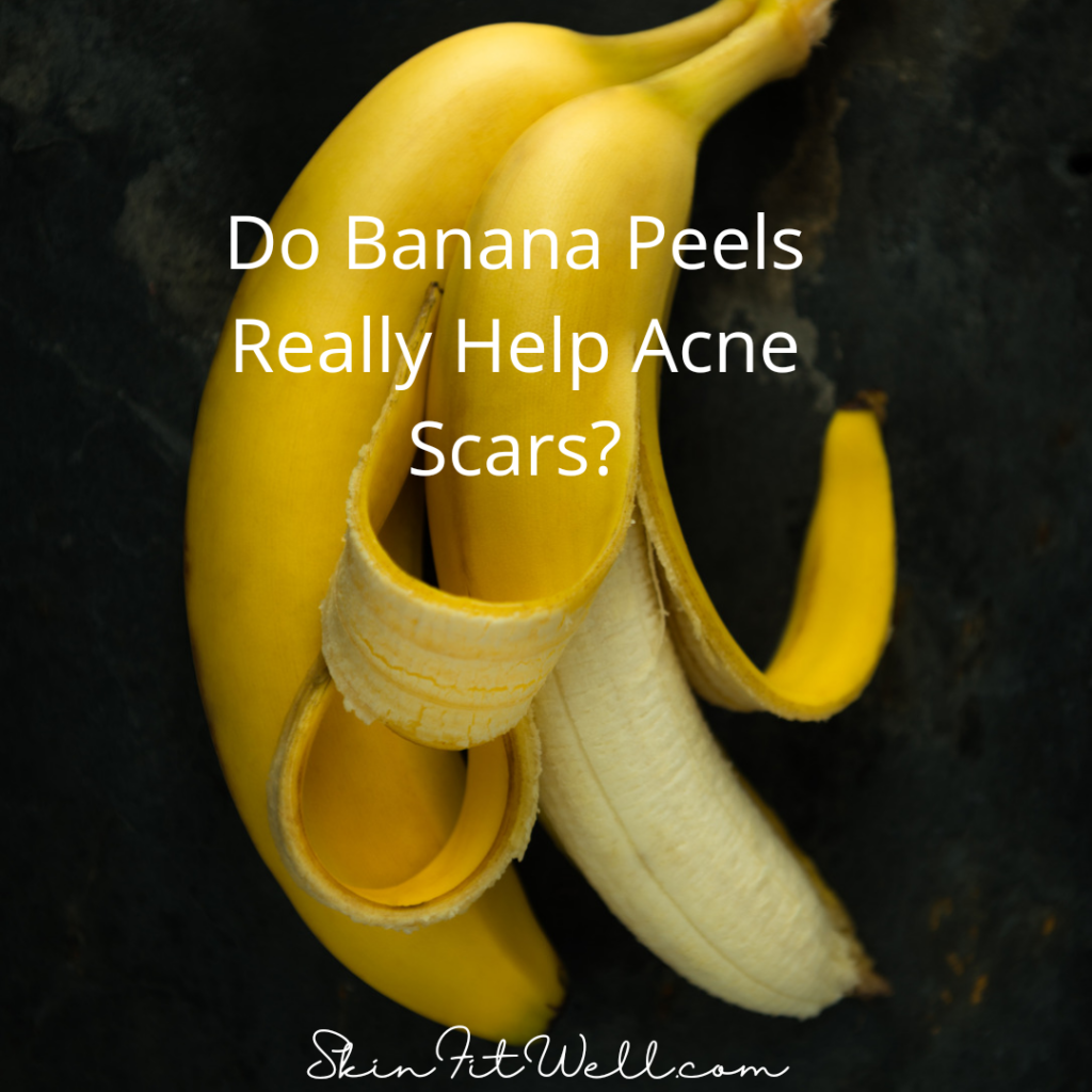 Do Banana Peels Really Help Acne Scars Skin Fit Well